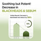 Korean Carbonic Acid Holy Basil Bubble Facial Mask Exfoliating Deep Cleansing Remove Blackhead Shrink Pore Oil Control Skin Care